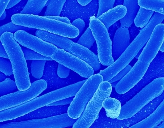  Men Acidophilus (Lactobacillus acidophilus) -công dụng? cách sử dụng như thế nào? 